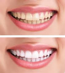 Cliquer pour agrandir